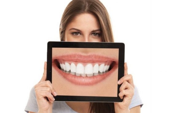diseño de sonrisas en Barcelona diseño de sonrisas en Barcelona
