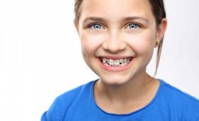 ortodoncia para niños en Barcelona