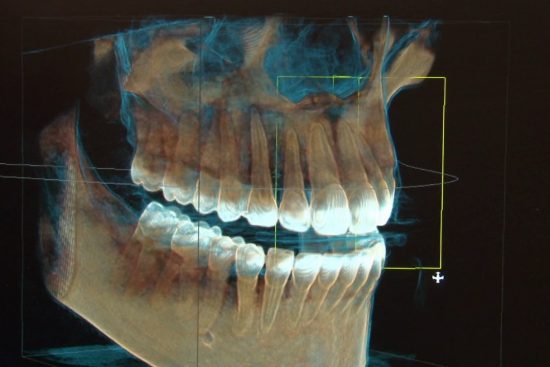 TAC 3D en Barcelona TACDenBarcelona